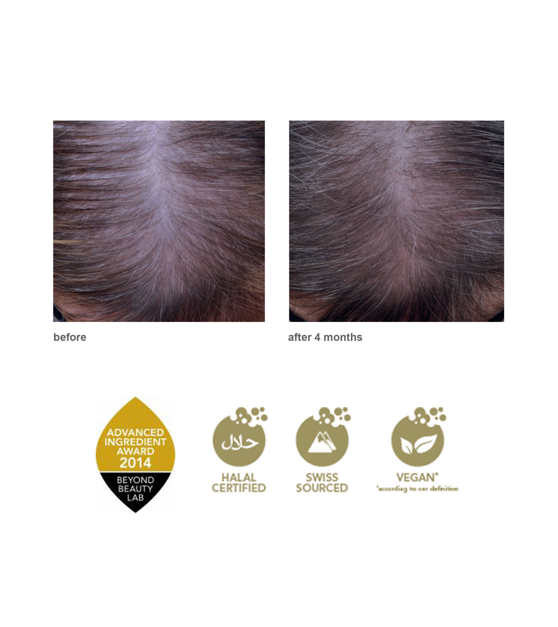 Procapil Hair Tonic Scalp Serum for Thinning Hair - Bondi Boost | Ulta  Beauty